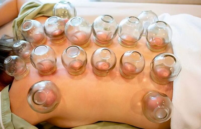 Giác hơi có nhiều phương pháp đa dạng
